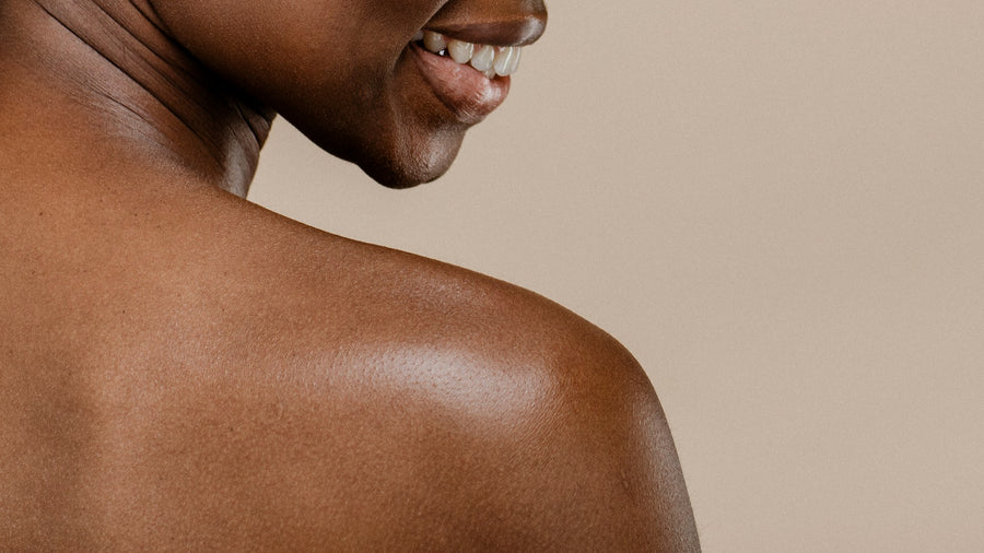Black woman's shoulder showing healthy, clean skin.